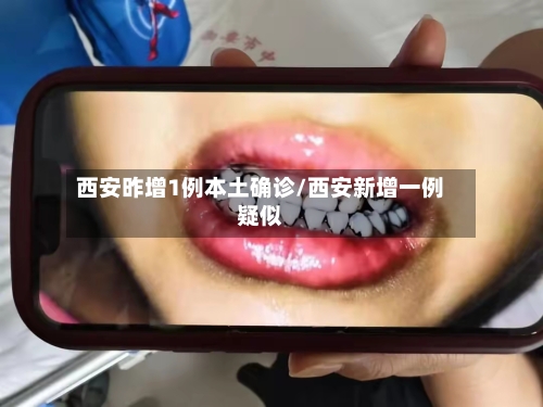 西安昨增1例本土确诊/西安新增一例疑似-第2张图片
