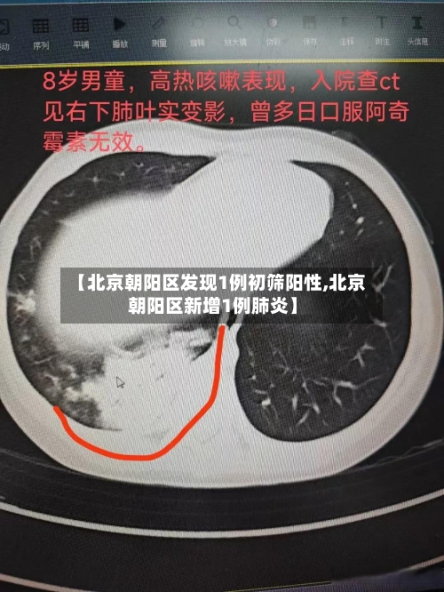 【北京朝阳区发现1例初筛阳性,北京朝阳区新增1例肺炎】