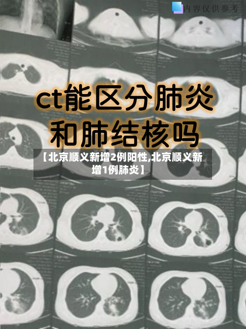 【北京顺义新增2例阳性,北京顺义新增1例肺炎】-第3张图片